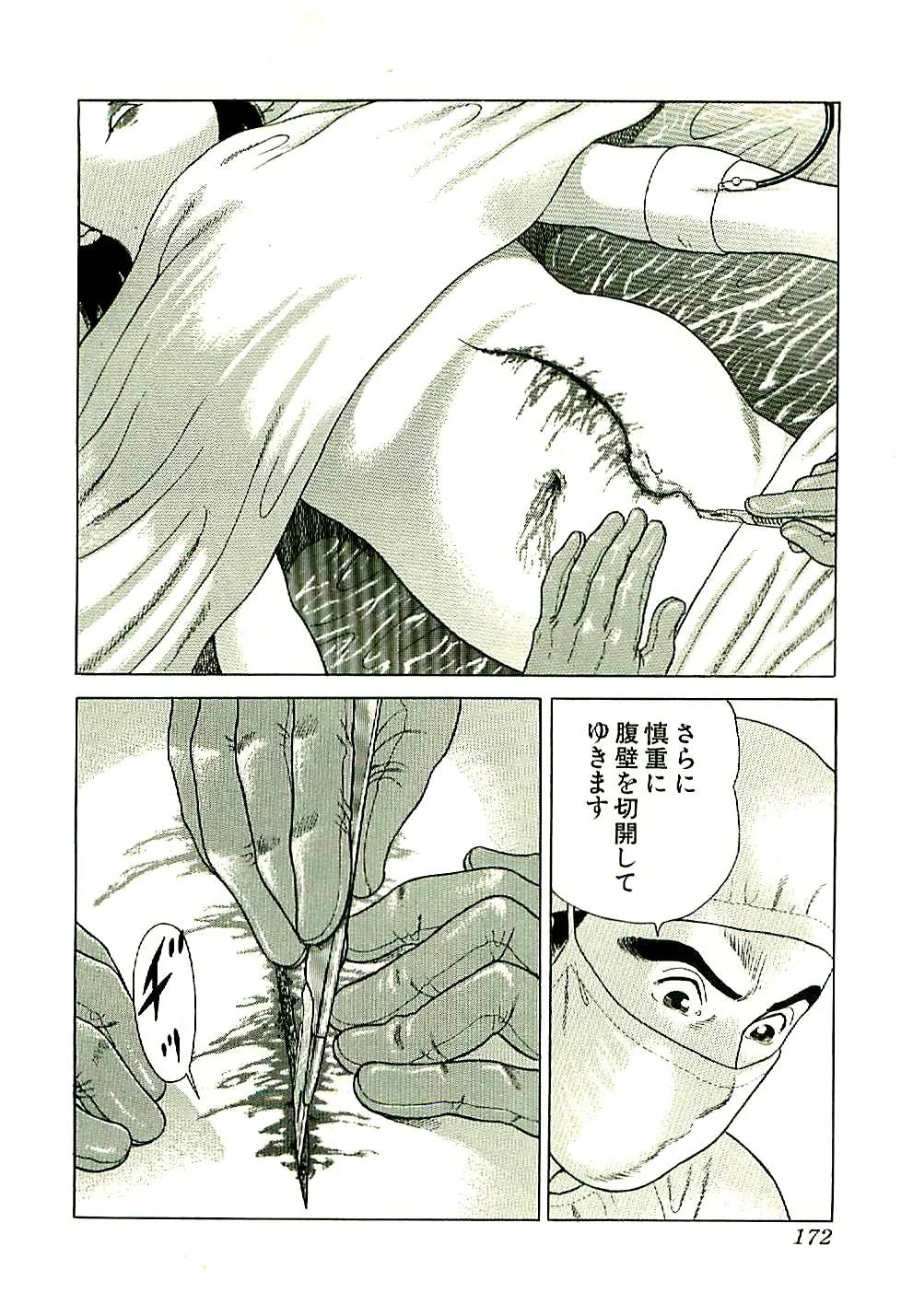 Page 172