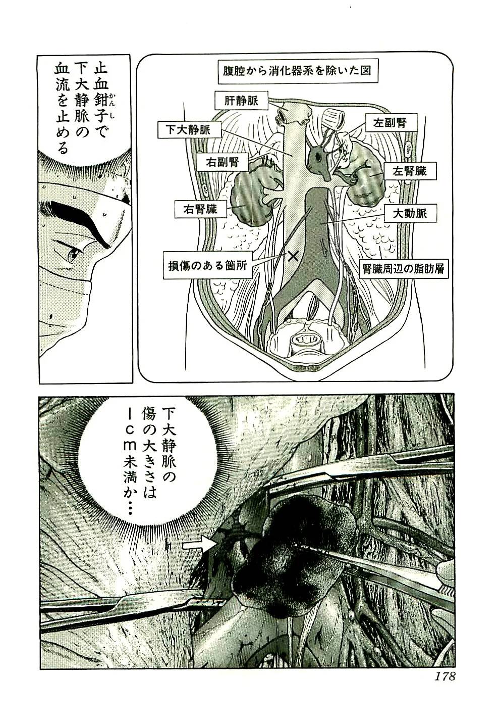 Page 178