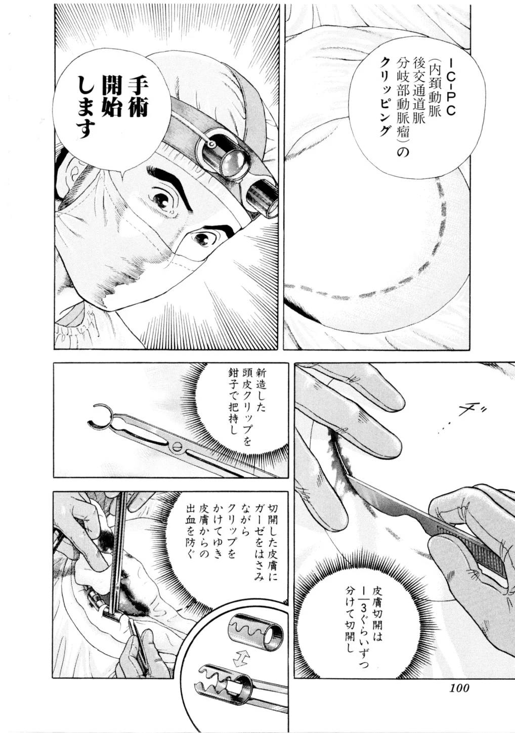 Page 100