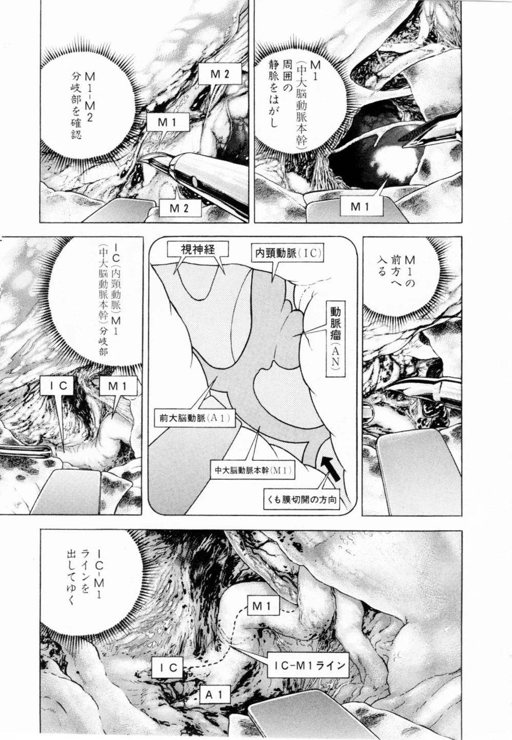 Page 115
