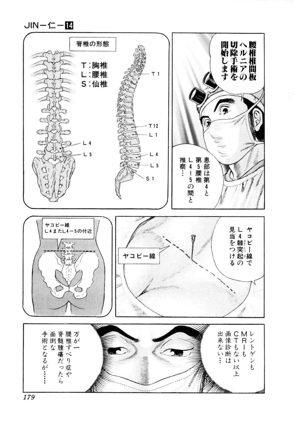 Page 179