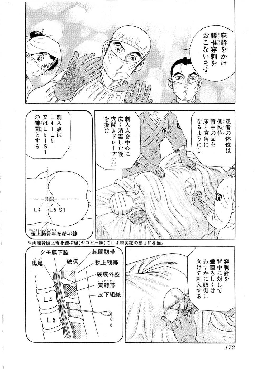 Page 172
