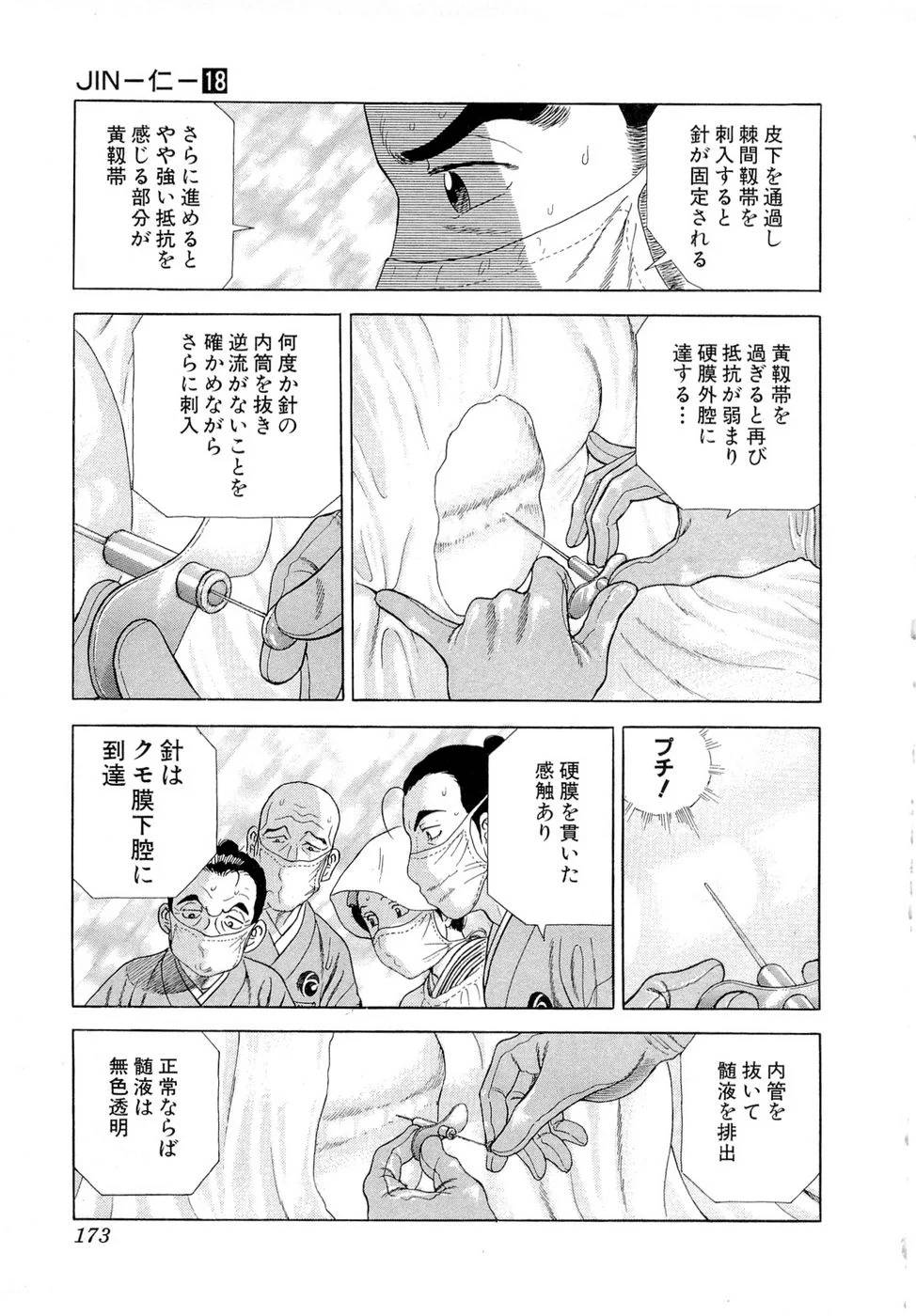 Page 173