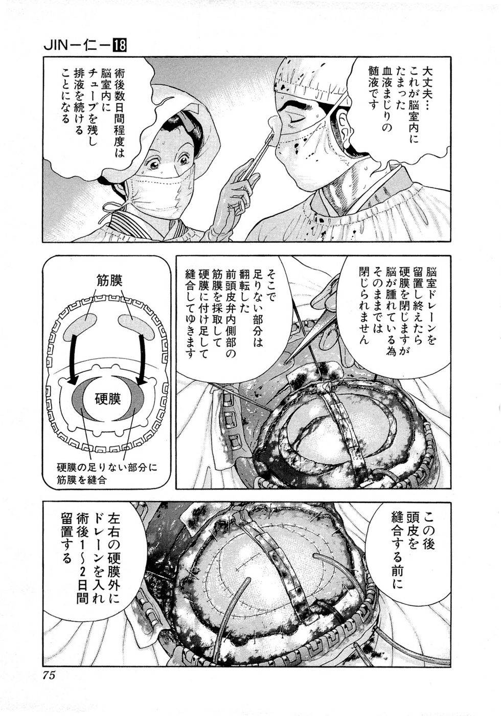 Page 75
