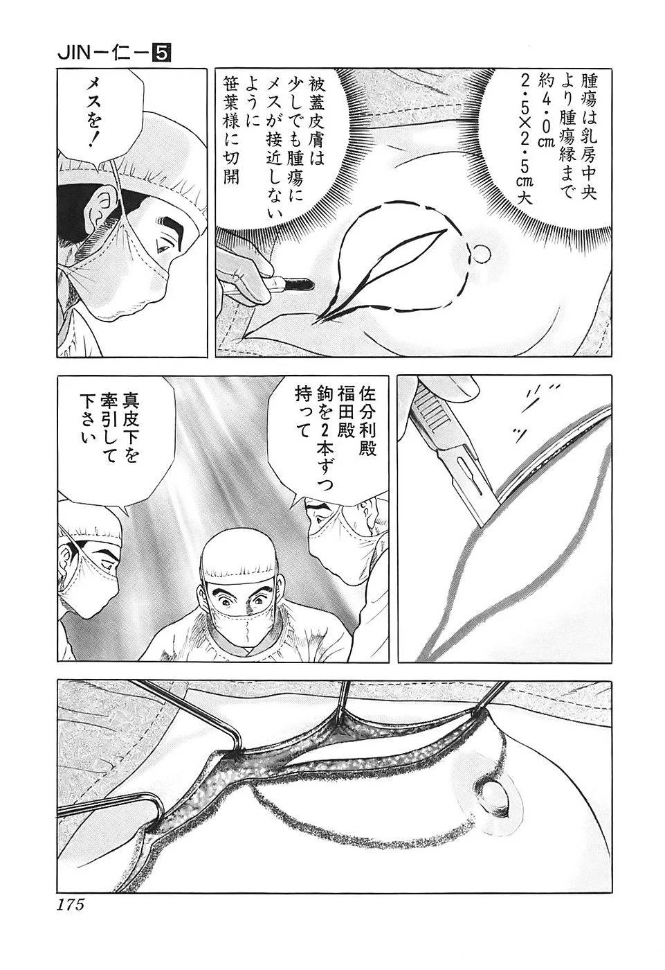 Page 175