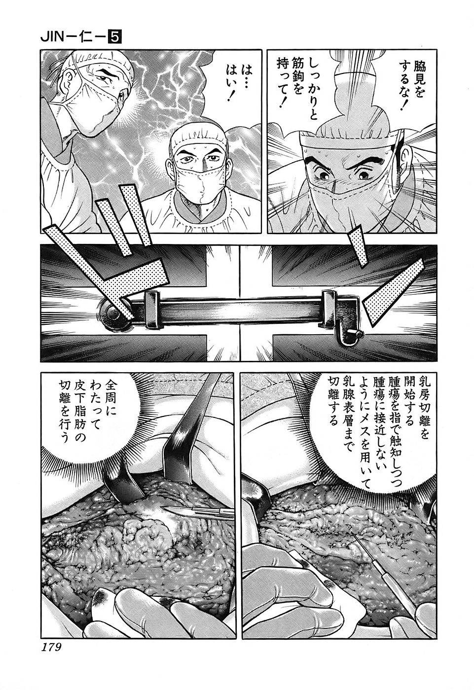 Page 179