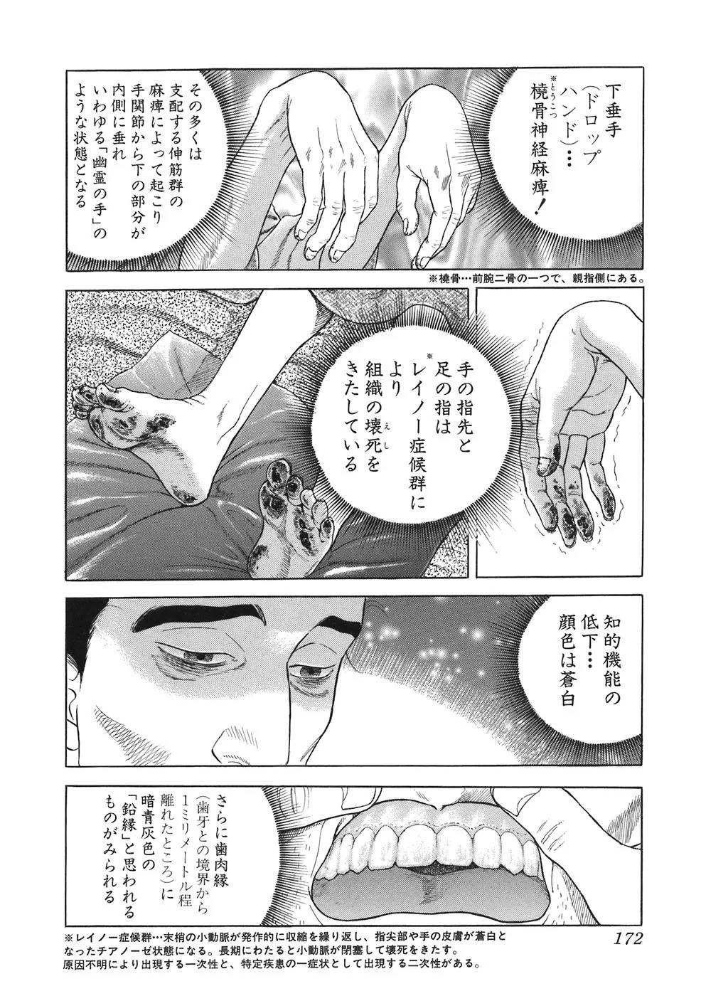 Page 164